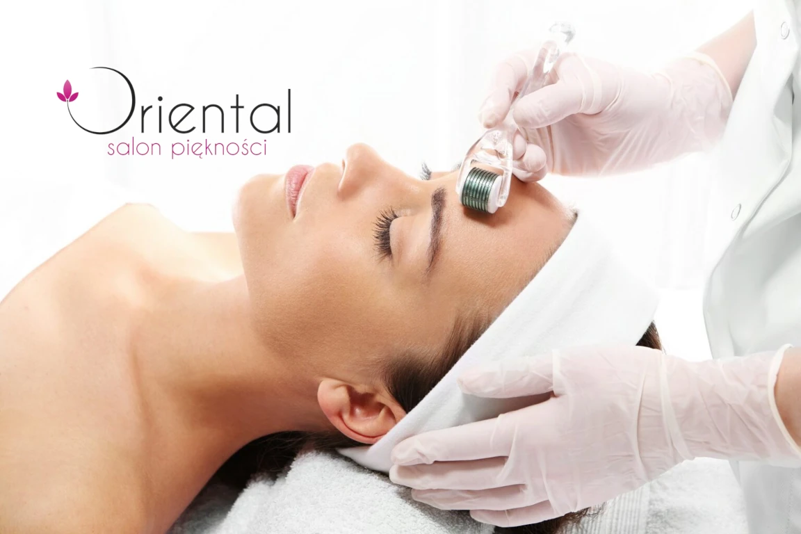 Skuteczne odmładzanie skóry - mezoterapia mikroigłowa w Salonie kosmetycznym ORIENTAL w Opolu